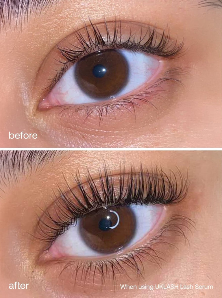 UKLASH