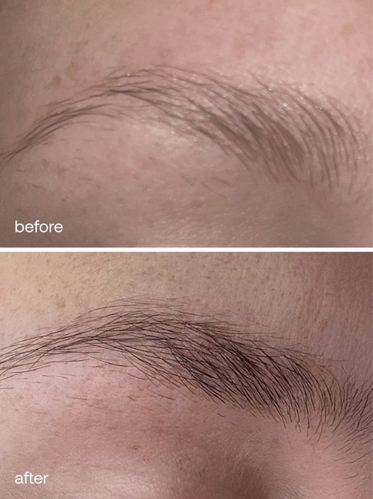Brows
